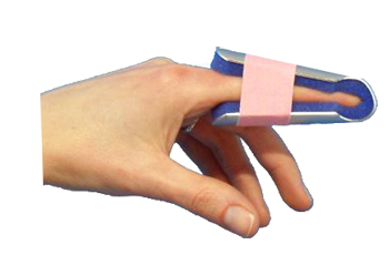 STECCA PER FRATTURA DITA A CAMPANA FARMASPLINT MISURA GRANDE PREFORMATA IN ALLUMINIO MODELLABILE CON IMBOTTITURA IN SPUGNA POLIURETANICA ANTIALLERGICA RADIOTRASPARENTE 15 CM - farmanauta.it