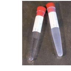 PROVETTA CONICA PER URINA 10ML - farmanauta.it