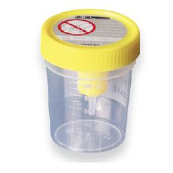 CONTENITORE URINA STERILE MEDIPRESTERIL CON SISTEMA TRANSFERT PER PROVETTE SOTTOVUOTO - farmanauta.it